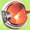 Bionic eye